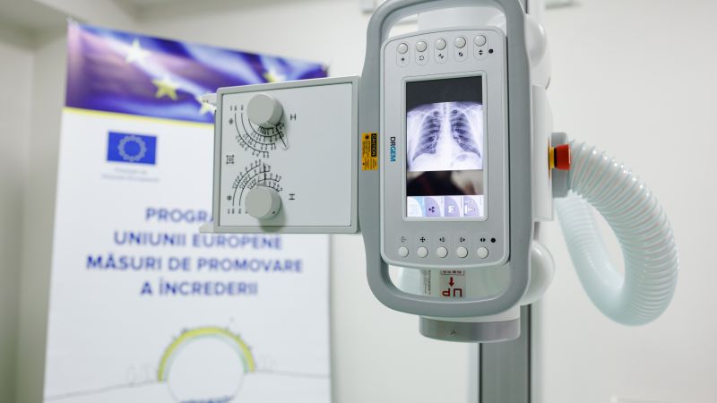 Centrul de Sănătate din Criuleni dispune de un laborator modern de radiologie și imagistică medicală, grație suportului Uniunii Europene și PNUD